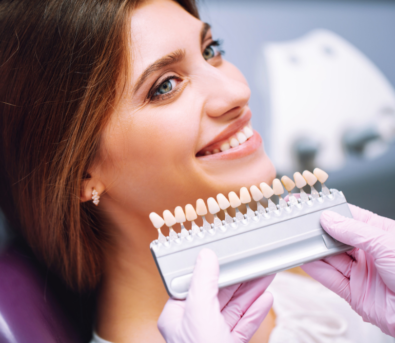 Wybielanie zębów - Blog Stomatologiczny