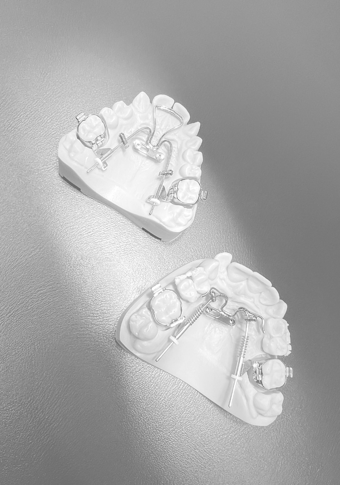 Mikroimplanty ortodontyczne