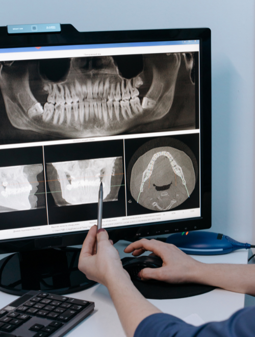 Diagnostyka Przed Zabiegiem - Tomografia zębów