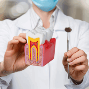 Leczenie Kanałowe Warszawa Wola - Endodoncja