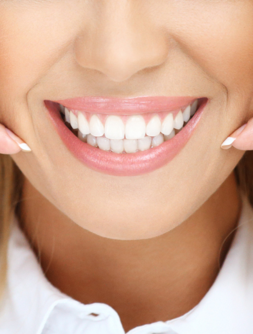 Bonding Zębów Warszawa