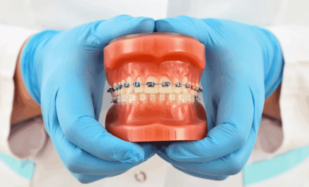 Aparat ortodontyczny